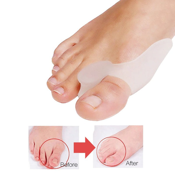 Pack Of 4 Pairs Silicone Gel Foot Fingers Hole Bunion Toe Separator Thumb Valgus Protectors